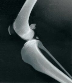 7010342081 | 3M ELEC PROD